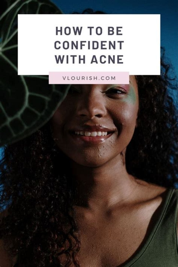 How To Be Confident With Acne?